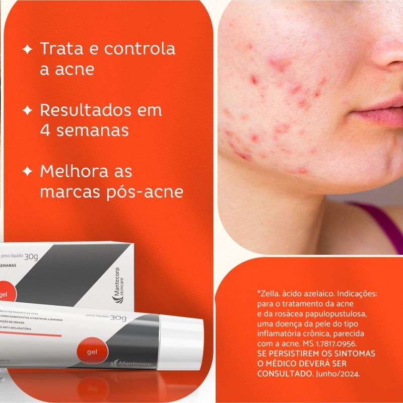 Gel-Facial-Zella-150mg-g-Acido-Azelaico-30g-1114779--4-